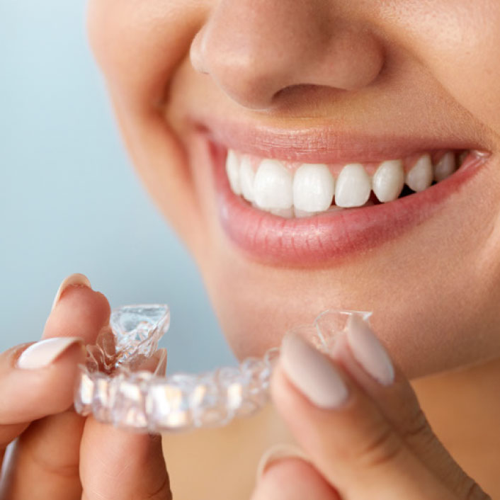 Invisalign® - Dental Services