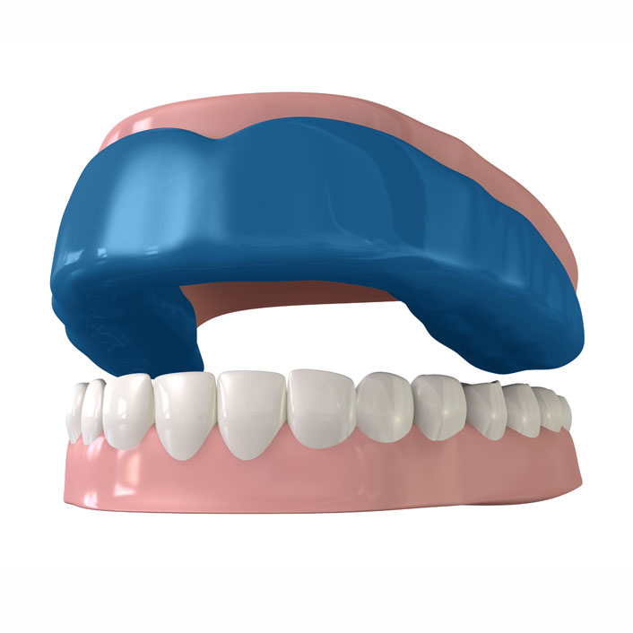 Athletic Mouth Guards - Dental Services