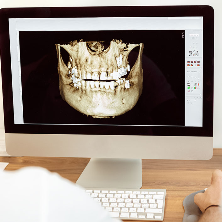 3D Imaging - Dental Services