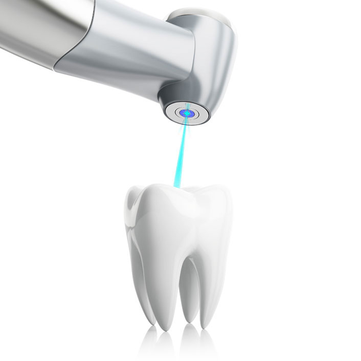 Waterlase Dentistry - Dental Technology